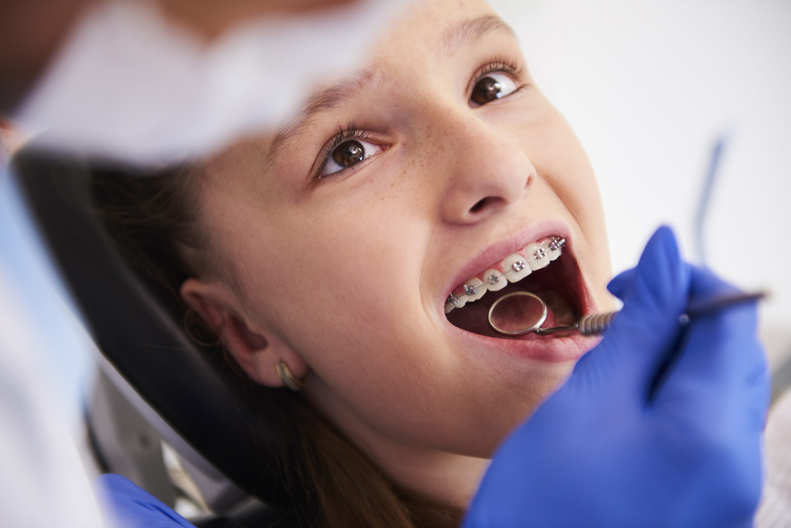 Girl with braces during a routine, dental examination General Anesthesia Dentistry in Batesville, IN